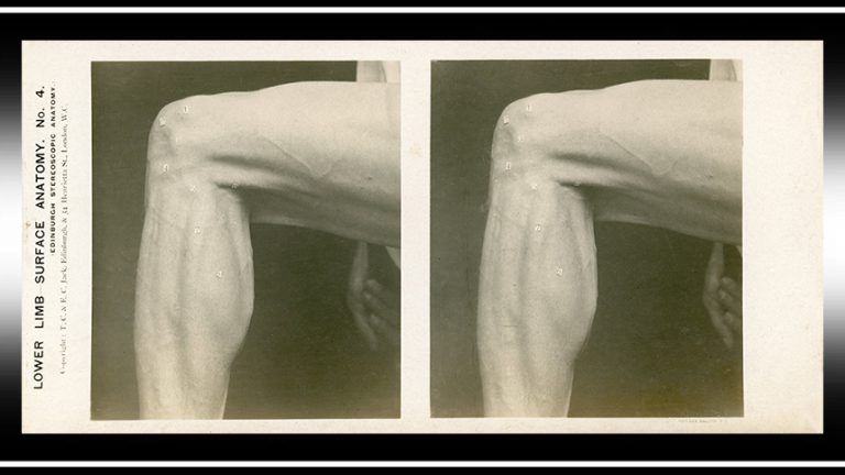 Medical Training and Visualization – Blog Stereoscopy